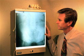 Chiropractic spinal adjustment illustration